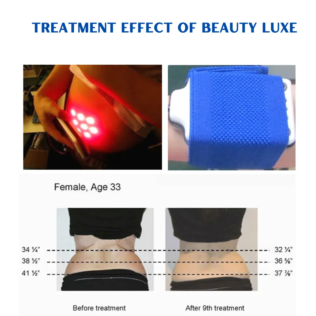 Beauty-Luxe Cavitation Machine